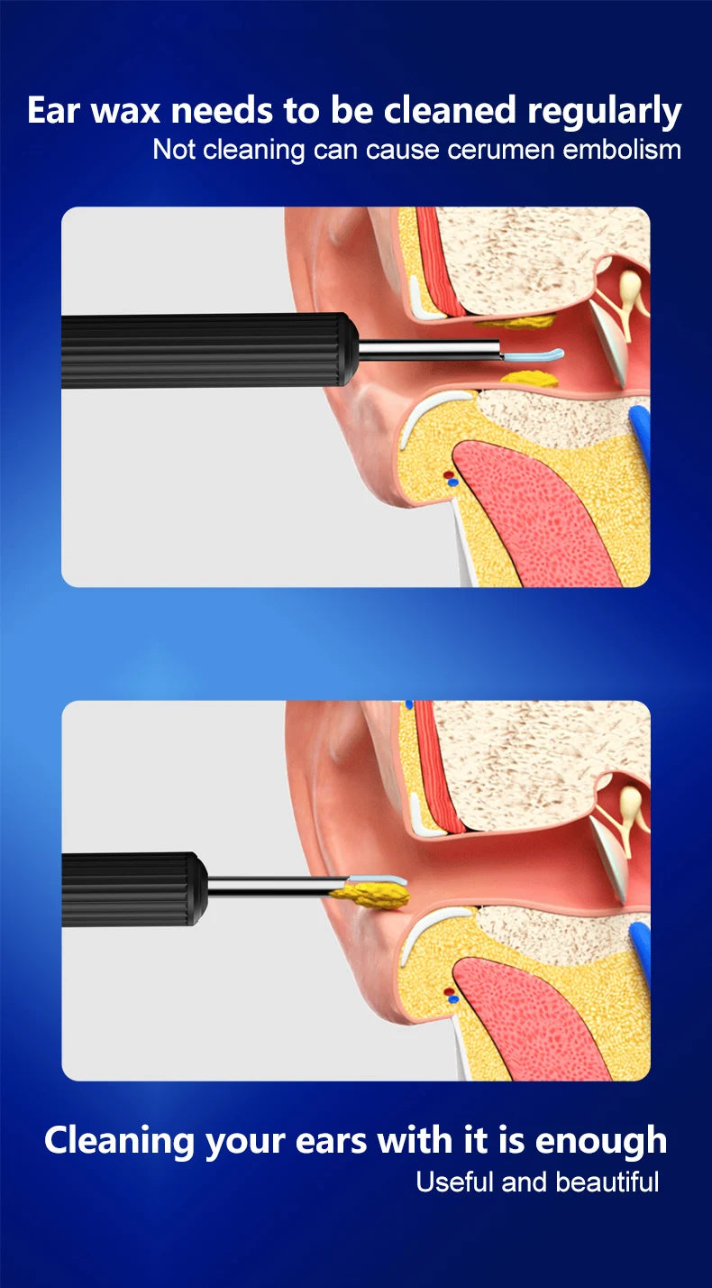 Ear Wax Removal Tool Camera Wireless Otoscope 1080P 3.9mm Ear Cleaner Camera Ear Endoscope Compatible for iPhone iPad Android